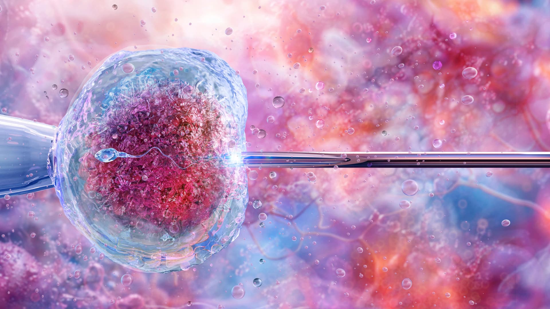 Újabb súlyos spermadonor-botrány