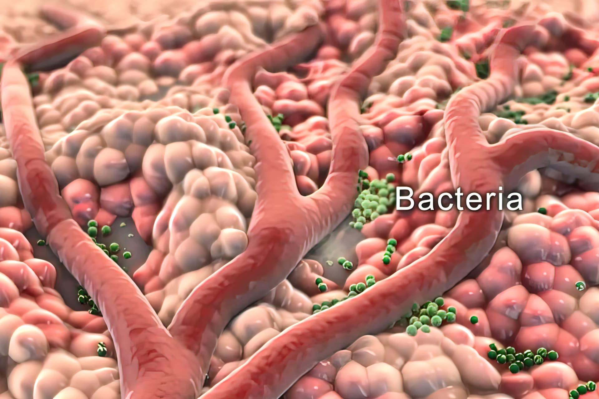 Ez az új antibiotikum könnyen felveszi a harcot a rezisztens baktériumokkal is