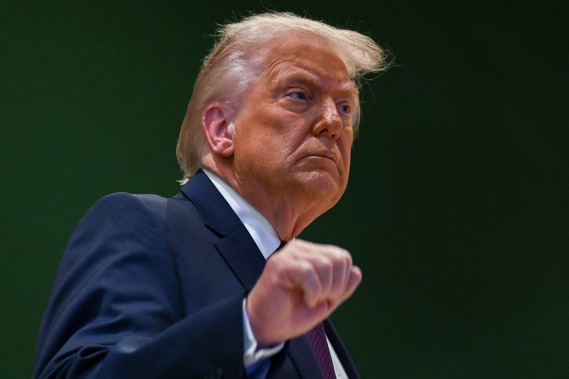 Trump elárulja, hogyan szerezte a kezén lévő nagy zúzódást