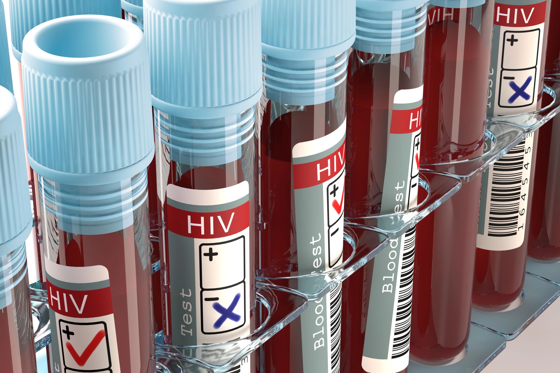 Riasztó méreteket ölt a HIV-járvány Oroszországban