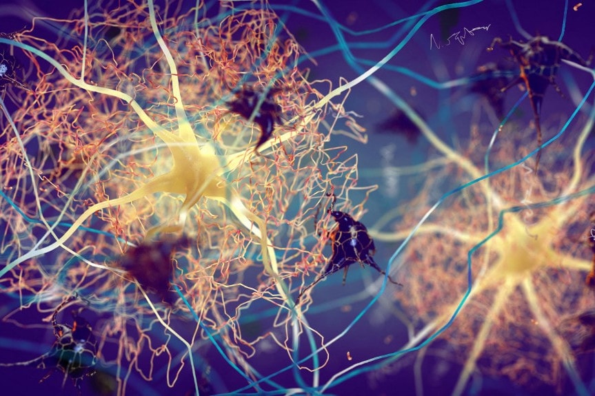 Új vérteszttel kimutatható az Alzheimer-kór