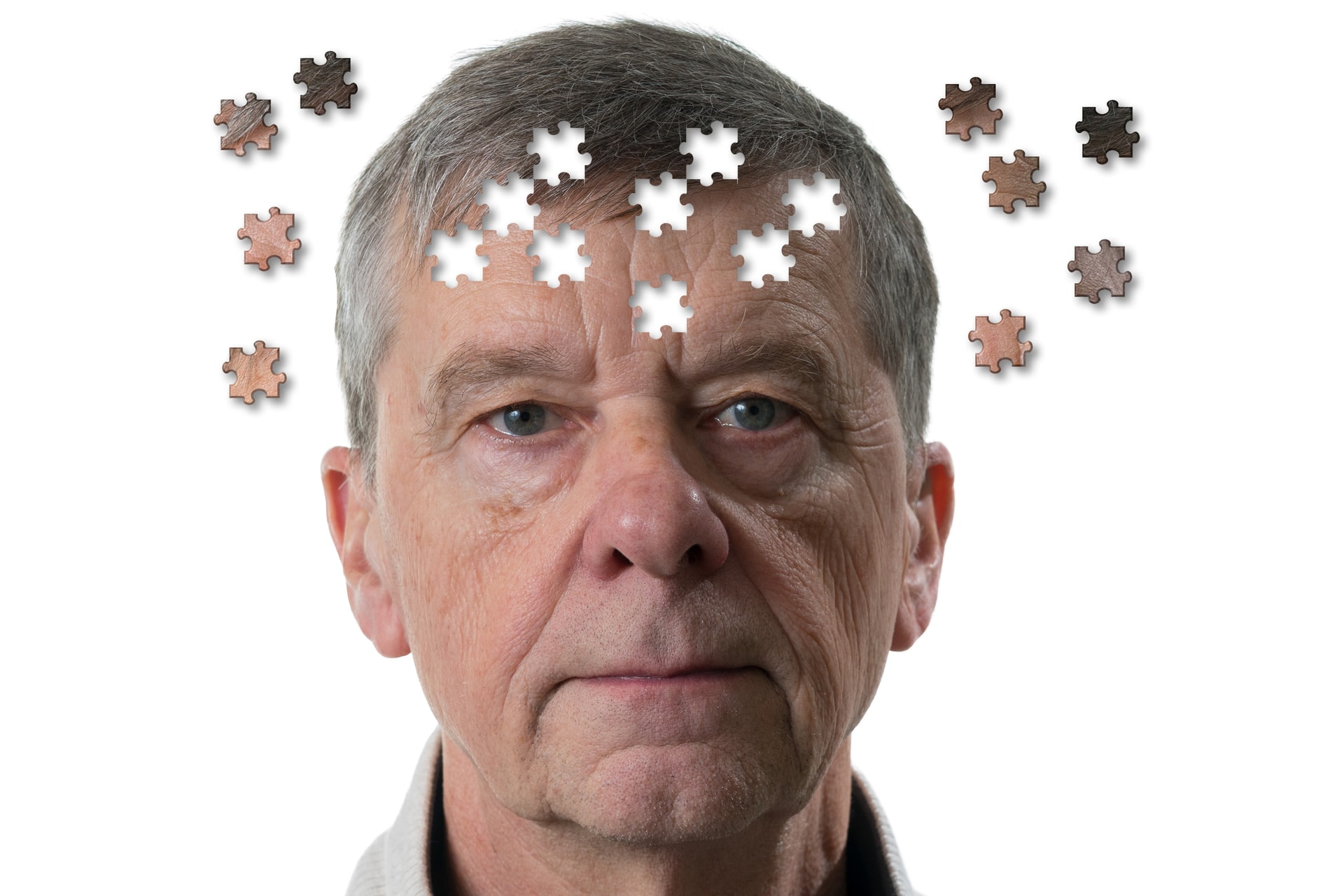 Az Alzheimer-kór diagnosztizálásának lehetséges új módja