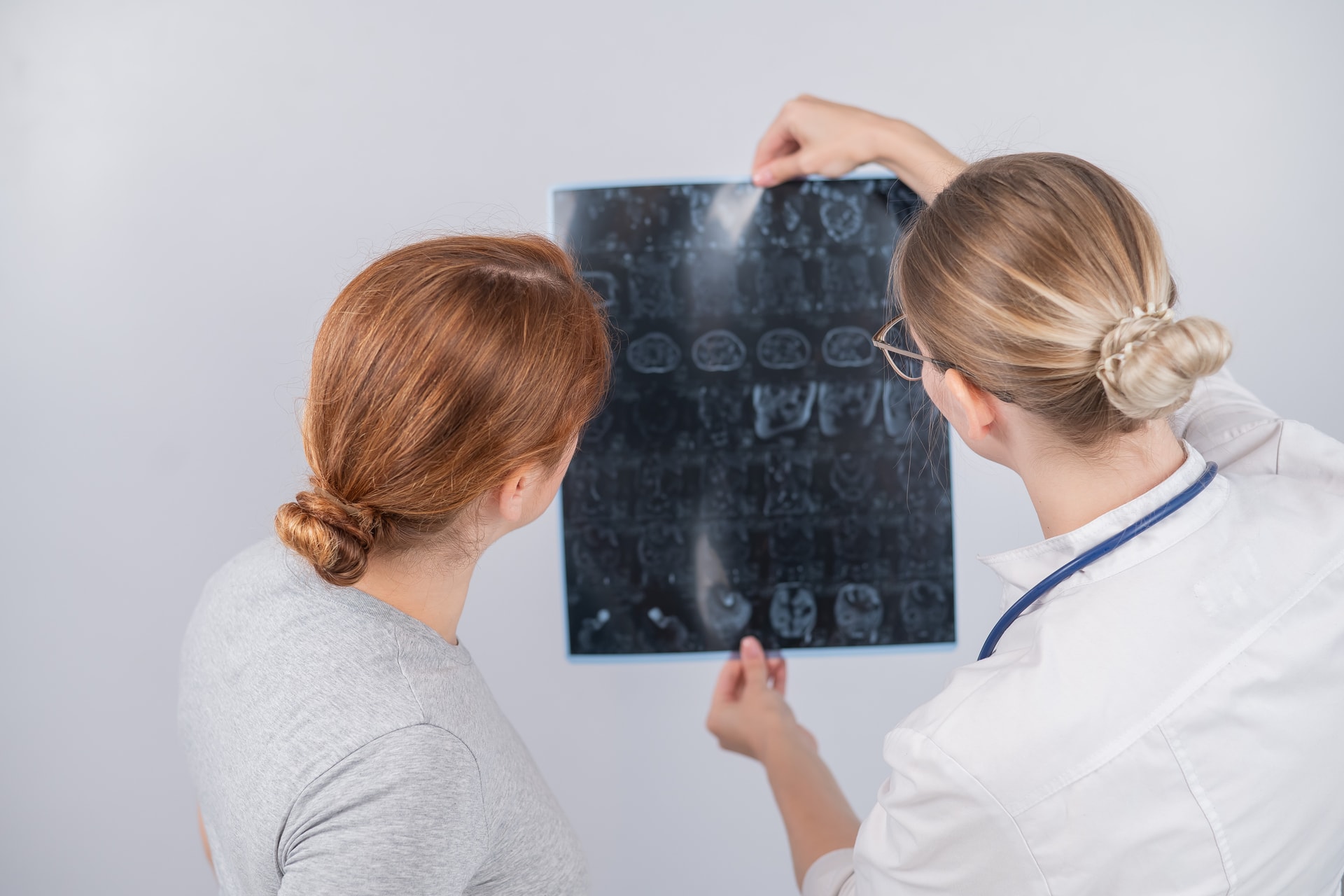 Intő jelek: néhány tünet, amely stroke előtt jelentkezik