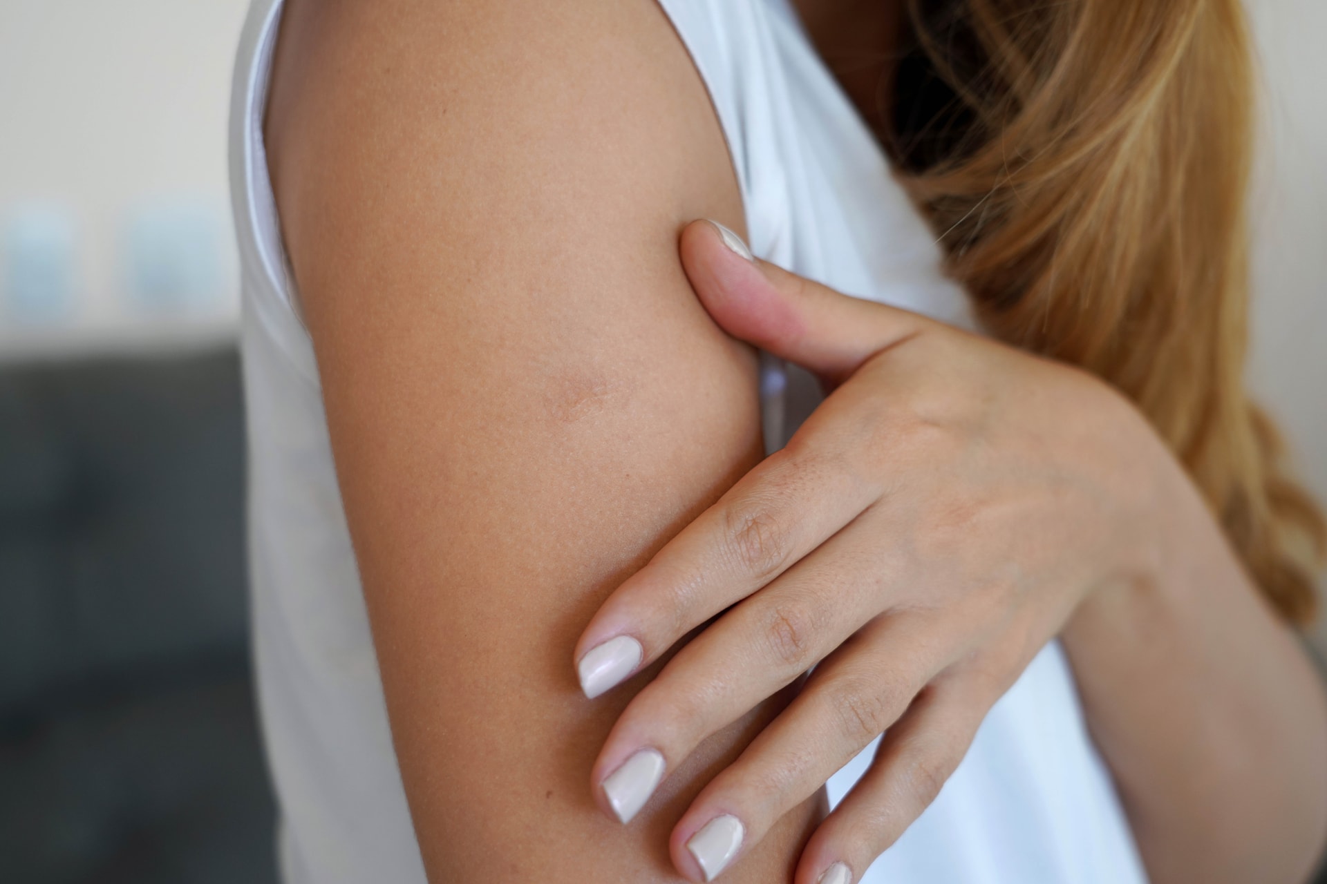 A viszkető bőr számos betegség tünete lehet