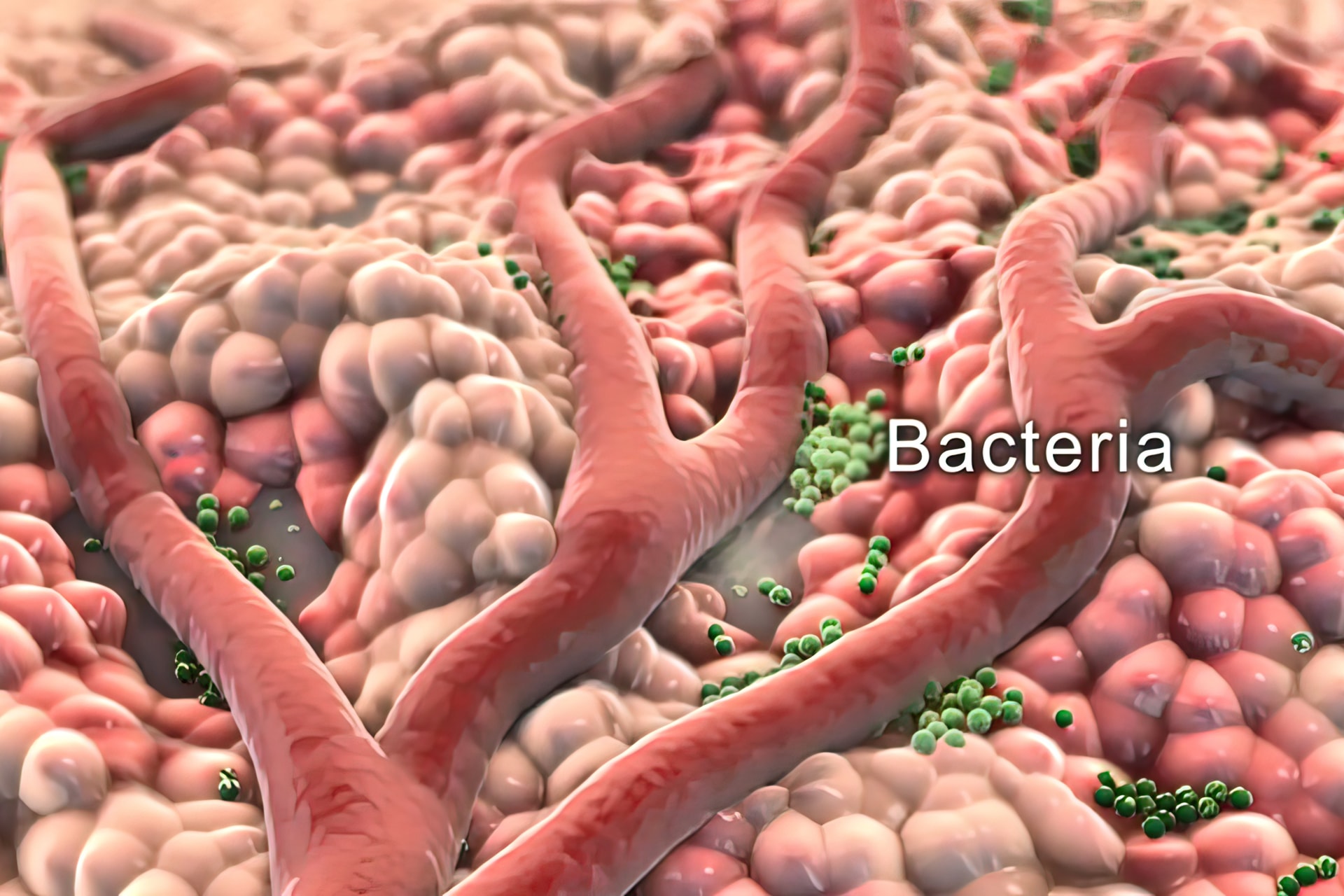 Ez az új antibiotikum könnyen felveszi a harcot a rezisztens baktériumokkal is