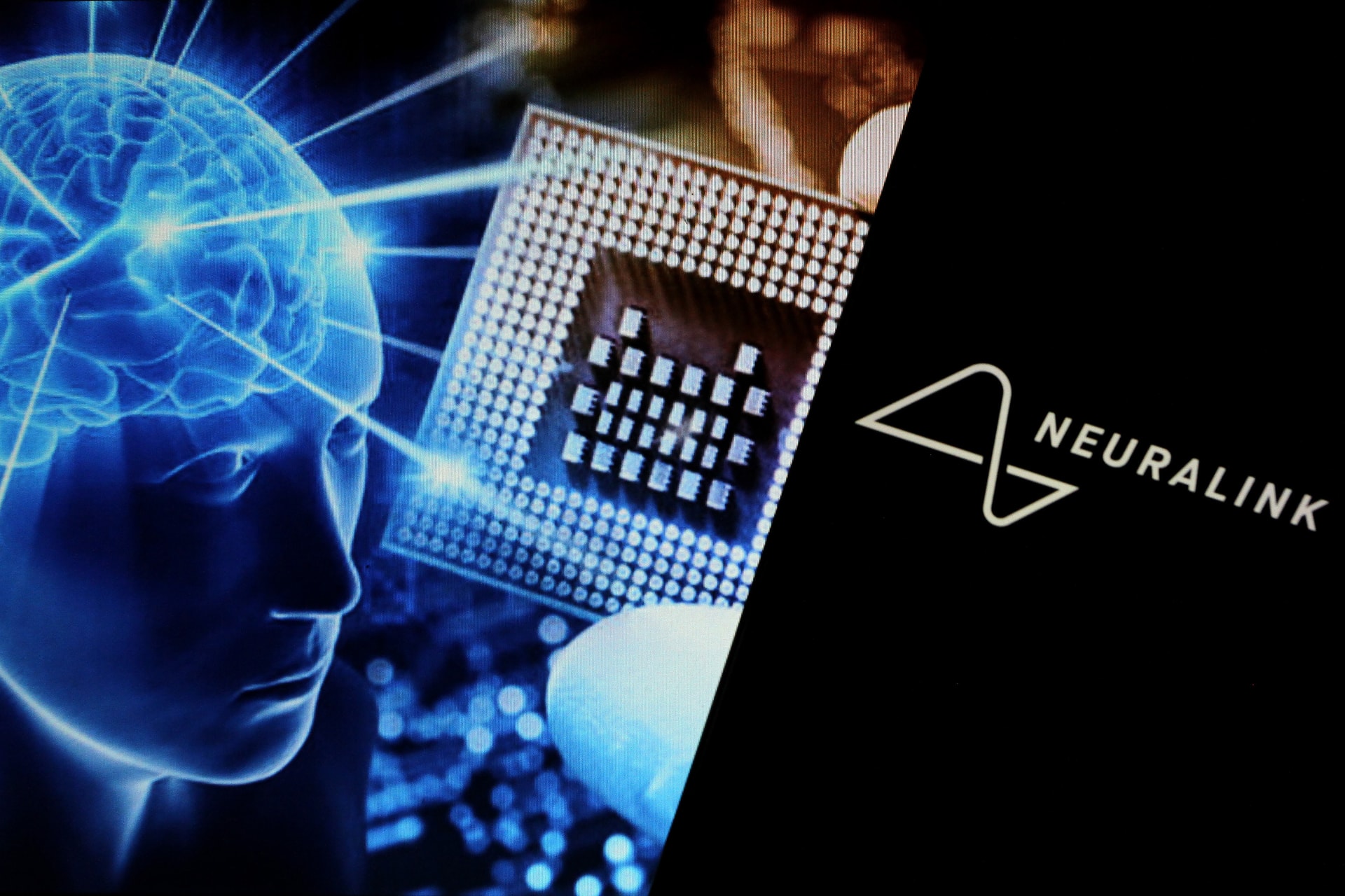 Az FDA aggasztó problémákat talált Musk Neuralink állatkísérleti laboratóriumában