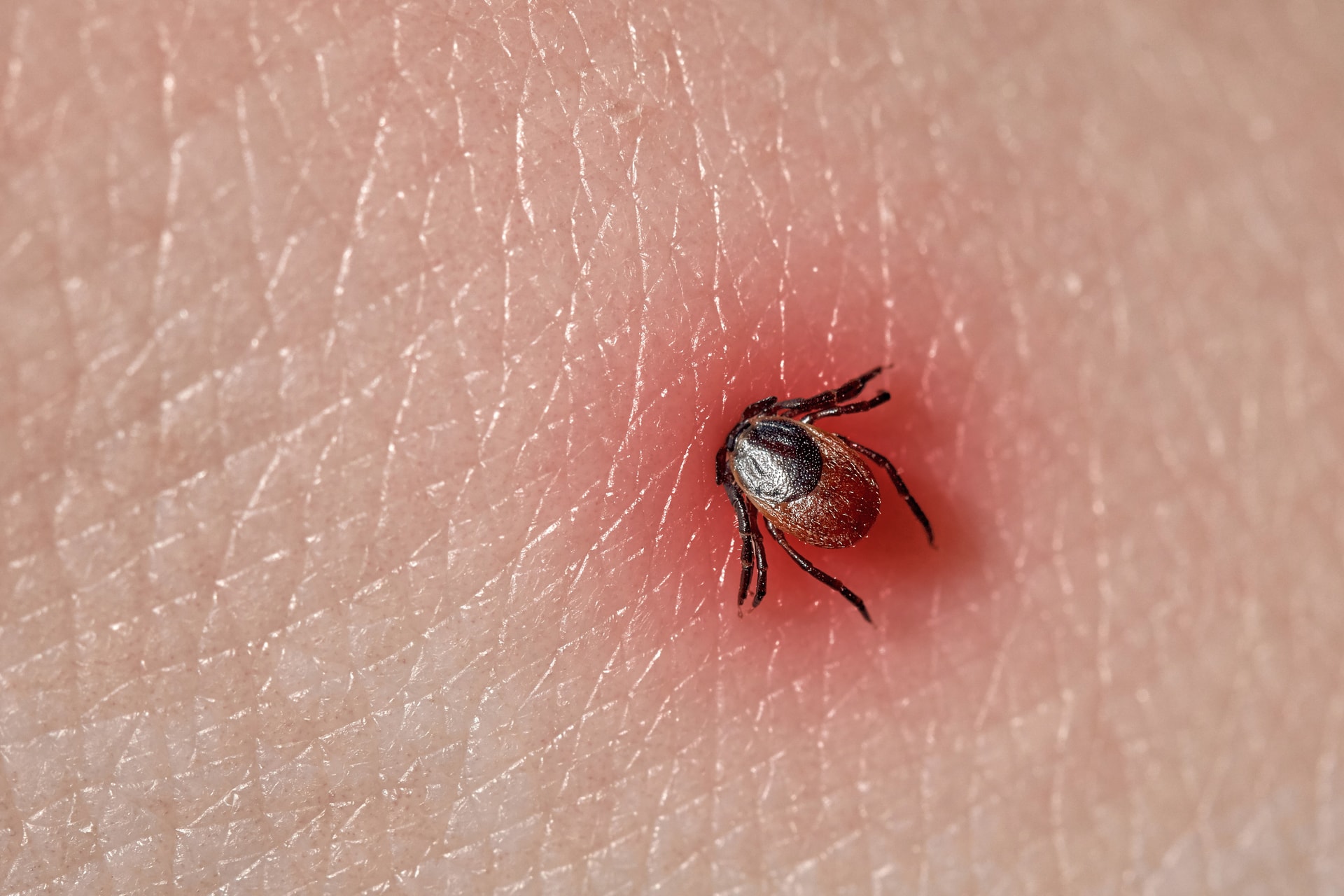 Megtalálhatták a Lyme-kór kezelésének tökéletes módját