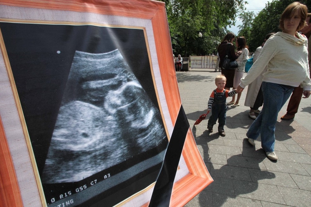 A Duma sem tartja jó ötletnek az abortusz betiltását
