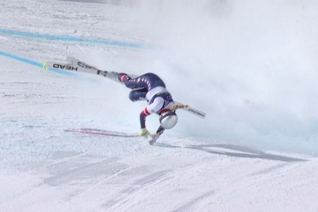 Lindsey Vonn orvosai titkolnak valamit?