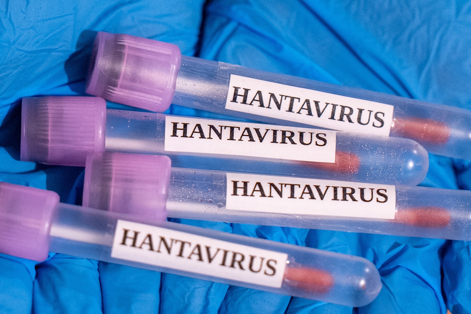 Hantavírus fertőzés gyanúja merült fel egy romániai betegnél
