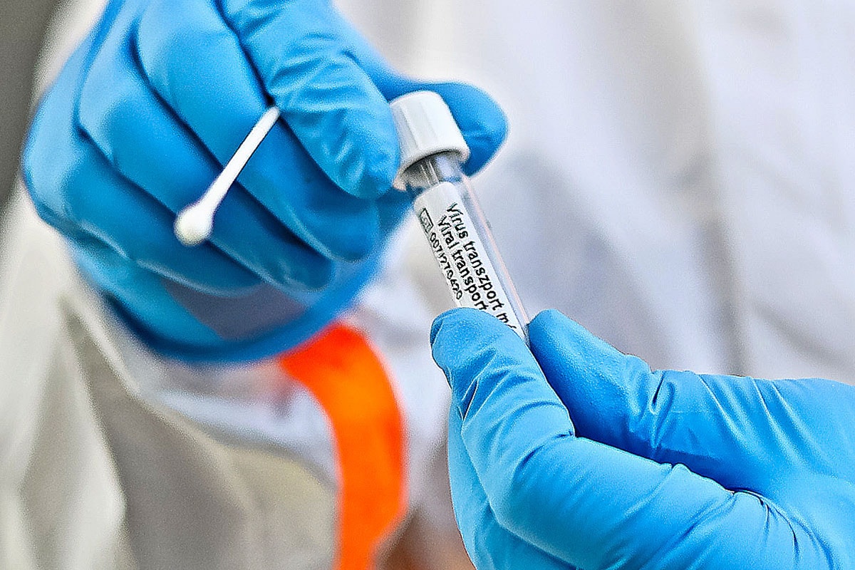 NNK: Karácsony téved, az antigén gyorstesztek nem alkalmasak szűrésre