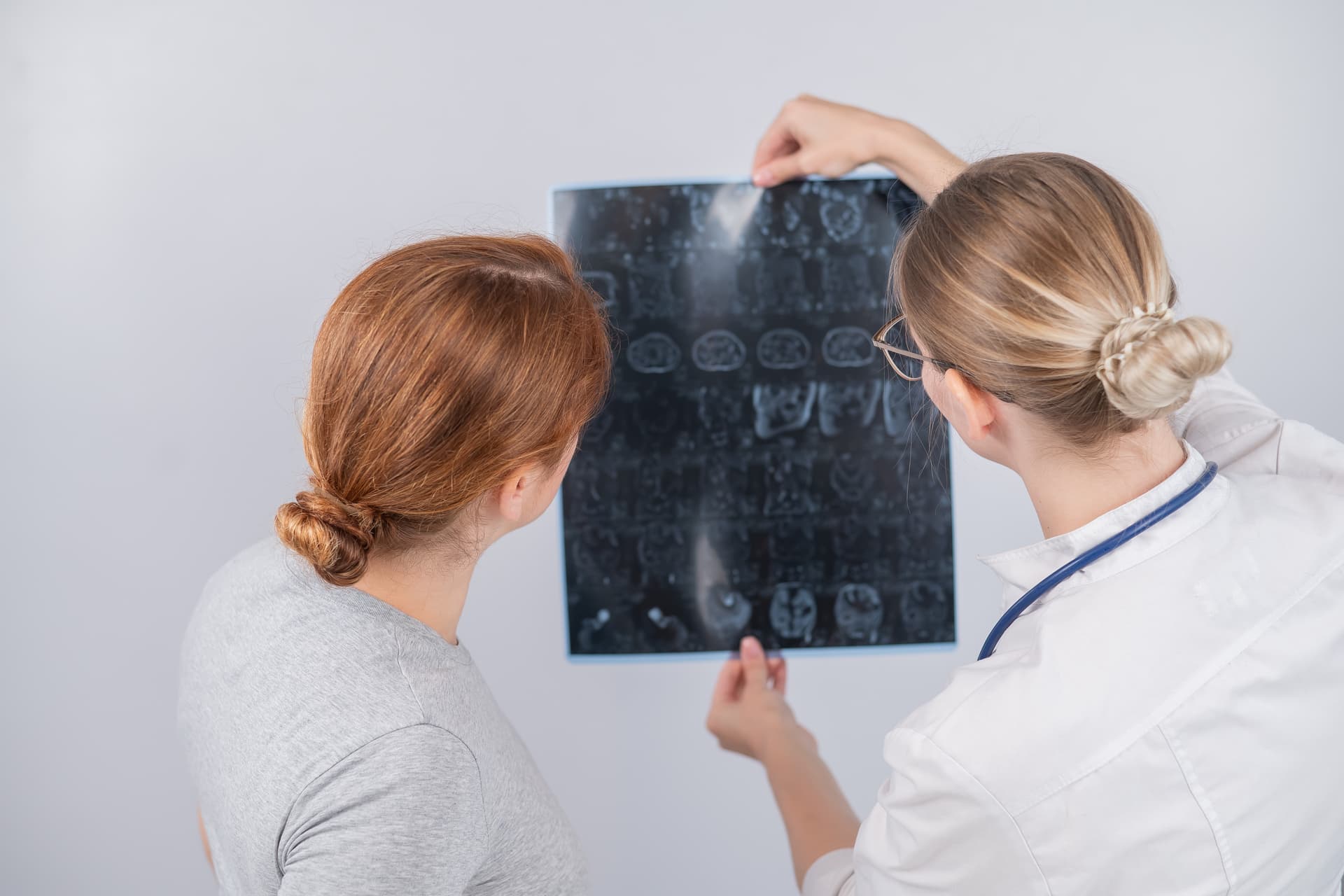 Intő jelek: néhány tünet, amely stroke előtt jelentkezik