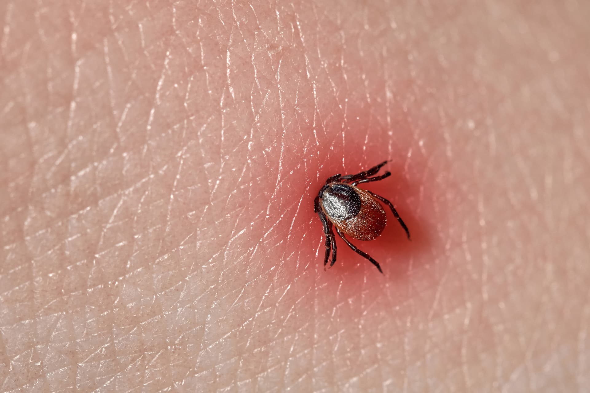 Megtalálhatták a Lyme-kór kezelésének tökéletes módját