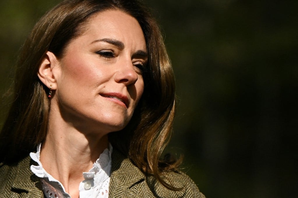 Valami furcsa dolog történik Katalin hercegné arcával