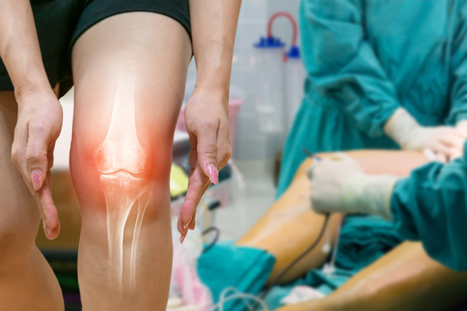 Milliók szenvednek osteoarthritisben – ez a diéta védi az ízületeket